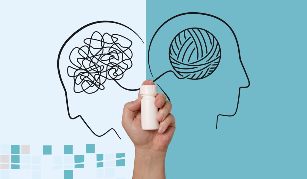  An evocative image showing two human heads side by side. The first head features tangled and disordered yarn, symbolizing poor mental health, while the second head has neatly arranged yarn, representing stability and well-being. In the center, a hand holds a pack of psychotropic medications, highlighting the role of these drugs in mental health treatment. This visual emphasizes the importance of understanding psychotropic medications, which are used to treat mental illnesses by affecting brain chemistry. The image reflects the regulatory landscape in Poland, where electronic prescriptions for such medications will be mandated from November 2023.